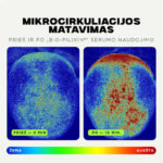 Scandinavian Biolabs Bio-Pilixin plaukų linijos aktyvatorius 5